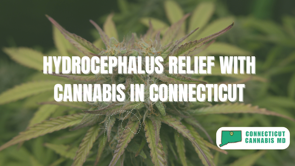 Hydrocephalus Relief with Cannabis in Connecticut