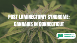 Post Laminectomy Syndrome: Cannabis in Connecticut